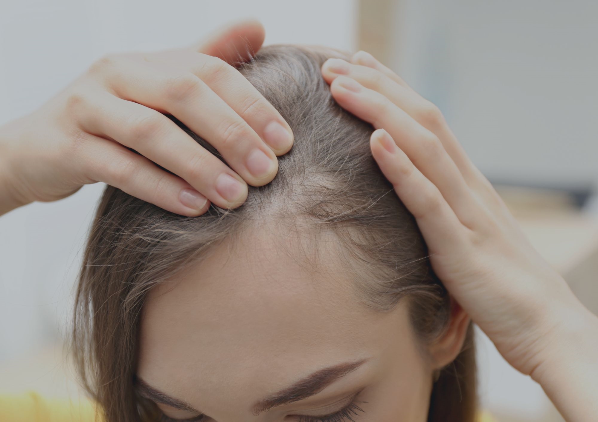 Woman suffering with thinning hair Woman suffering with thinning hair